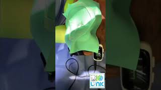 Clinical Case of Eighteeth Airpex Wireless Apex Locator by Dr Carlos Saucedo [upl. by Uhej]