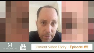 FUT Hair Transplant Review – Day 2 After Surgery 3943 Grafts – Video Diary 8 [upl. by Salis]