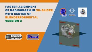 Faster 3D Slicer Segmentation alignment with Blenderfordental Center  Version 2 [upl. by Kalinda]