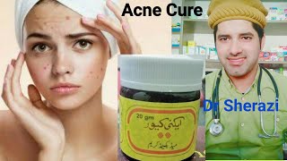 Acne Cure Cream  Ance Pimples How To Cure Face Fleck Homeopathic Medicine and cream [upl. by Robinia487]