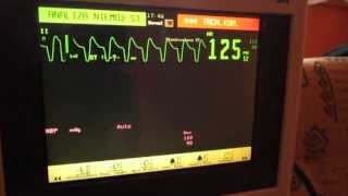 EKG Monitor [upl. by Clovis466]