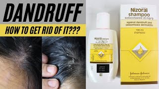 Dandruff  Flaky Itchy Scalp  Nizoral Shampoo Review [upl. by Canada]