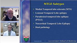 Medial Temporal Lobe Epilepsy Evaluation Preview [upl. by Alinna372]