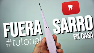 COMO QUITAR EL SARRO 💩 DE LOS DIENTES EN CASA 🏡 con este APARATO ⛏ TUTORIAL [upl. by Wrand881]