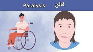 فالج  Paralysis [upl. by Eixam]