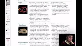 Cardiomyopathies and Heart Failure [upl. by Yelac]