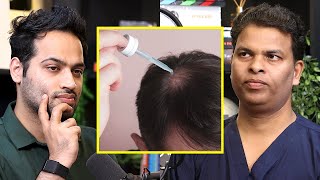 Are Minoxidil And Finasteride Good For Hair Growth Raj Shamani Clips [upl. by Aiuqat]