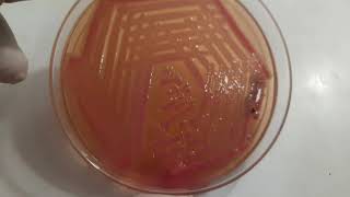 Acinetobacter Klebsiella and Bacillus growth on culture media and Gram Stain Microscopy [upl. by Abdel]