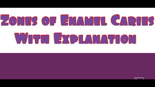 Zones of enamel caries [upl. by Alessandro]