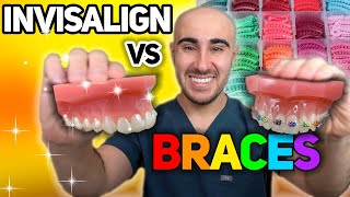 Braces vs Invisalign Cost Tooth Pain Speed etc  The ULTIMATE Review 🔥 [upl. by Peppy506]