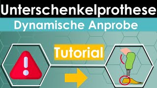 Unterschenkel PROTHESEN Aufbau Tutorial Dynamische Anprobe [upl. by Nal]