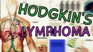 Hodgkins Lymphoma  Types  Symptoms  Staging  Treatment  Diagnosis Hodgkins Lymphoma Explained [upl. by Pincas375]