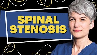 Spinal Stenosis What You Need to Know [upl. by Trofmoc486]