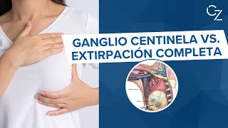 Ganglio Centinela vs Extirpación Completa [upl. by Trudy]