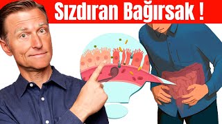 Sızdıran Bağırsakların 7 İşareti  Dr Berg Türkçe [upl. by Nyl]