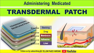 Transdermal Medicated patch  Transdermal patch  Transdermal Drug Delivery TDD  Made Easy [upl. by Lelith18]