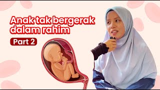 Part 2  Baby tak bergerak dalam rahim [upl. by Claudio]