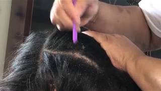 Scalp Check amp Dandruff Scratching with Momma Pt 2 [upl. by Nizam325]