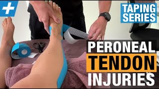 How to Tape for Peroneal Tendon Injuries [upl. by Annoya]