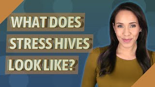 What does stress hives look like [upl. by Einwat34]