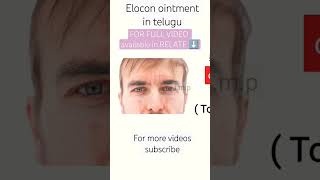 elocon ointment review in telugu  full video in relate button medicine fact [upl. by Netsua]