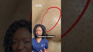 Black Dots on the Nose Sebaceous Filaments amp How To Get Rid Of Them  Products [upl. by Arihppas]