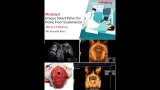 What is Smart Pelvic  by Mindray [upl. by Eliam]