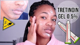 I STARTED USING TRETINOIN GELRETINA FOR MY ACNE  HERES WHAT HAPPENED ♡ OfficialTashika [upl. by Odranar]