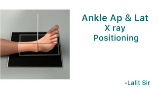 Ankle x ray positioning [upl. by Ancalin]