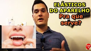 Elástico do aparelho para que serve [upl. by Odilia]