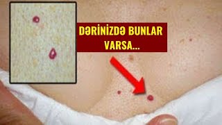 DİQQƏT Sizdə bu 10 əlamətdən biri varsa ÜRƏYİNİZ DÜZ İŞLƏMİR [upl. by Nhguavad]