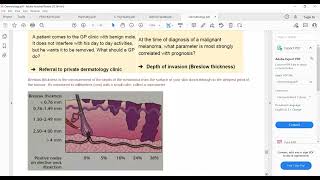 Plab 1 Lecturers Dermatology Part 13 Skin CancersDermal Melanosis XanthlaesmaLipomaParonachya [upl. by Annenn]