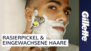 Eingewachsene Haare amp Rasierpickel Tutorial  Gillette ProShield [upl. by Zurciram]