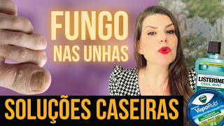 Remédios CASEIROS para o FUNGO DAS UNHAS  o 3o É INACREDITÁVEL [upl. by Aneeuqal299]