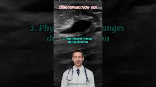 Breast Duct Dilatation Differential Diagnoses radiology [upl. by Esinrahc397]