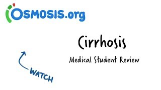 Cirrhosis Overview  Clinical Presentation [upl. by Eirellam]