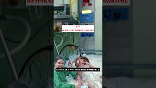 neonatal RDS respiratory distress syndrome  NICU videos  hospital videos  drpoonam [upl. by Nica]