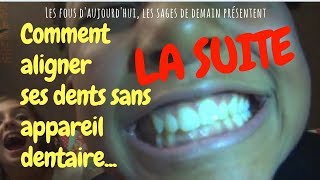 Comment aligner ses dents sans appareil dentaire  La suite [upl. by Mussman]