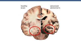 How does the brain work [upl. by Earehs]