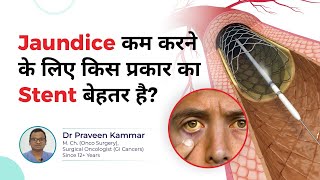 Best Stent for Bile Duct CancerRelated Jaundice  Metal or Plastic Stent  Dr Praveen Kammar [upl. by Bron]