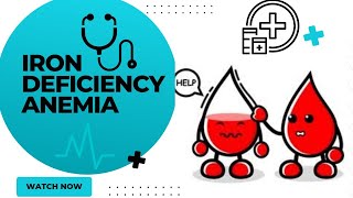 Iron deficiency anemiairon deficiency anemia treatmentanemia notesiron deficiency anemia symptoms [upl. by Ingelbert855]