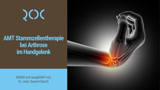 AMT Stammzellentherapie bei Arthrose im Handgelenk  ROC Aschheim [upl. by Eneleoj]