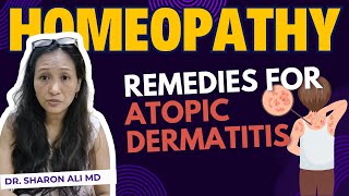 Homeopathy for Atopic Dermatitis  Dr Sharon Ali MD [upl. by Ches499]