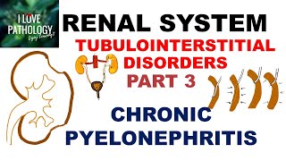 CHRONIC PYELONEPHRITIS  PATHOLOGY [upl. by Hanselka424]