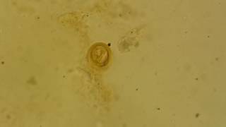 Fertilised decorticated egg of Ascaris lumbricoides [upl. by Aronos]