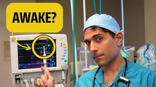 How To Tell If A Patient Is Awake Under Anesthesia And What To Do [upl. by Ykcor303]