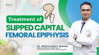 Treatment of Slipped Capital Femoral Epiphysis SCFE  Hip Slip in Children  Dr Puneet Mishra [upl. by Ramhaj]