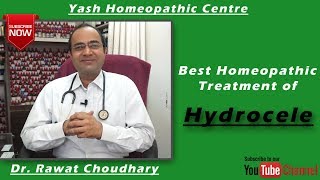 Best Homeopathic Treatment of Hydrocele  Yash Homeopathic Centre Jodhpur [upl. by Dugald]