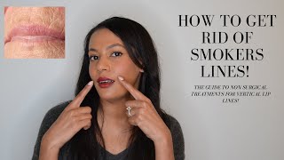 How To Get Rid of Smokers Lines Lip Wrinkles and Vertical Lip lines 👄 [upl. by Asela]