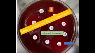 Viridans Streptococci Introduction isolation and pathogenesis [upl. by Loggia421]